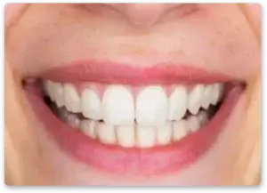 A patient of Designer Smiles after cosmetic dental treatment in Fargo.
